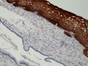 IHC staining of FFPE human cervix tissue with recombinant Cytokeratin 14 antibody at 1:2000.