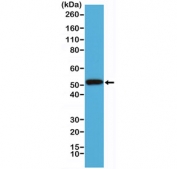 Western blot testing of human A431 cell lysate with recombinant Cytokeratin 14 antibody at 1:1000. Predicted molecular weight ~53 kDa.