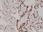 IHC staining of FFPE human placenta tissue with recombinant HCGb antibody at 1:1000.