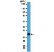 Western blot testing of hCG protein purified from humanurine using recombinant HCGb antibody at 1:20,000. Predicted molecular weight ~18 kDa (beta subunit) and ~26 kDa (hCG complex), but can be observed at up to ~40 kDa due to glycosylation.