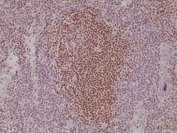 IHC staining of FFPE human tonsil tissue with recombinant PAX-5 antibody at 1:1000.