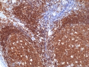 IHC staining of FFPE human tonsil tissue with recombinant CD19 antibody at 1:1000.