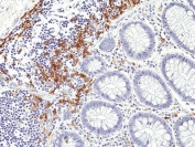 IHC staining of FFPE human colon tissue with recombinant CD19 antibody at 1:1000.