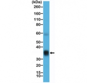 Western blot testing of human lung tissue lysate with recombinant Surfactant protein A antibody at 1:10,000. Predicted molecular weight: ~26 kDa but may be observed at higher molecular weights due to glycosylation.