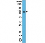 Western blot testing of human LNCaP cell lysate with recombinant CD276 antibody at 1:10,000 dilution. Expected molecular weight: 57-110 kDa depending on level of glycosylation.