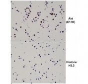 IHC staining of FFPE human 293T cells transfected with a DNA construct encoding the AKT E17K mutation or Histone H3.3, using recombinant AKT E17K Mutant antibody.