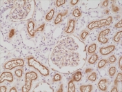 IHC staining of FFPE human kidney tissue with recombinant CD10 antibody at 1:200.