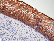 IHC staining of FFPE human cervix tissue with recombinant Cytokeratin 5/6 antibody at 1:1000.