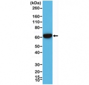 Western blot testing of human A431 cell lysate with recombinant Cytokeratin 5/6 antibody. Predicted molecular weight: ~62 kDa (KRT5) and ~60 kDa (KRT6).
