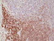 IHC staining of FFPE human tonsil tissue with recombinant CD4 antibody at 1:500.