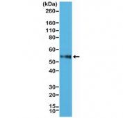 Western blot testing of human Jurkat cell lysate with recombinant CD4 antibody at 1:2500. Expected molecular weight: 50-55 kDa.