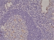 IHC staining of FFPE human tonsil tissue with recombinant Spastin antibody at 1:1000.