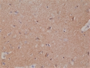 IHC staining of FFPE human brain tissue with recombinant Spastin antibody at 1:1000.