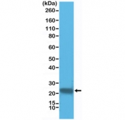 Western blot testing of human HeLa cell lysate with recombinant GST pi antibody at 1:1000. Predicted molecular weight ~23 kDa.