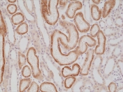 IHC staining of FFPE human kidney tissue with recombinant AMACR antibody at 1:1000.