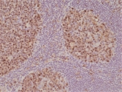 IHC staining of FFPE human tonsil tissue with recombinant STMN1 antibody at 1:1000.