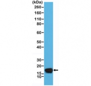 Western blot testing of human HeLa cell lysate with recombinant STMN1 antibody at 1:5000 dilution. Expected molecular weight ~17 kDa.
