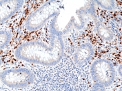IHC staining of FFPE human appendix tissue with recombinant IRF4 antibody at 1:800.