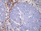 IHC staining of FFPE human tonsil tissue with recombinant IRF4 antibody at 1:800.