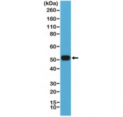 Western blot testing of human Raji cell lysate with recombinant IRF4 antibody at 1:2000 dilution. Predicted molecular weight ~51 kDa.
