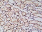 IHC staining of FFPE human kidney tissue with recombinant p120-Catenin antibody at 1:5000.