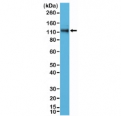 Western blot testing of human A431 cell lysate with recombinant p120-Catenin antibody at 1:500 dilution. Predicted molecular weight of ~108 kDa but commonly observed at 66-120 kDa (multiple isoforms).