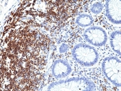 IHC staining of FFPE human colon tissue with recombinant CD5 antibody at 1:1000.