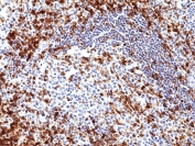 IHC staining of FFPE human tonsil tissue with recombinant CD5 antibody at 1:1000.