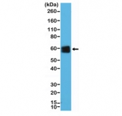 Western blot testing of human Jurkat cell lysate with recombinant CD5 antibody at 1:25,000 dilution. Observed molecular weight: 55-67 kDa depending on glycosylation level.
