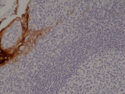 IHC staining of FFPE human tonsil tissue with recombinant KRT4 antibody at 1:1000.