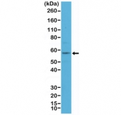 Western blot testing of human A431 cell lysate with recombinant KRT4 antibody at 1:100 dilution.