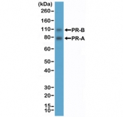 Western blot testing of human T-47D cell lysate with recombinant PR antibody at 1:2000 dilution. Expected molecular weight: 82-94 kDa (PR-A) and 99-120 kDa (PR-B).
