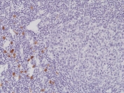 IHC staining of FFPE human tonsil tissue with recombinant CD117 antibody at 1:2000.