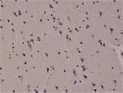 IHC staining of FFPE human brain tissue with recombinant ALK antibody at 1:1000.