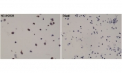 Immunohistochemical staining of FFPE NCI-H2228 cells (expressing EML4-ALK variant 3) and Daudi cells (ALK negative) with recombinant ALK antibody.