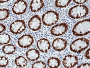 IHC staining of FFPE human colon tissue with recombinant SATB2 antibody at 1:1000.