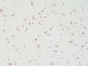IHC staining of FFPE human brain tissue with recombinant SATB2 antibody at 1:200.