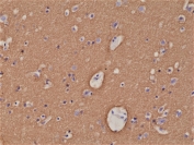 IHC staining of FFPE human brain tissue with recombinant STX1A antibody at 1:1000.