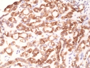 IHC staining of FFPE human thyroid tissue with recombinant Thyroid Peroxidase antibody at 1:1000.