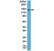 Western blot testing of human TT cell lysate with recombinant Thyroid Peroxidase antibody at 1:200. Predicted molecular weight ~103 kDa but may be observed at higher molecular weights due to glycosylation.