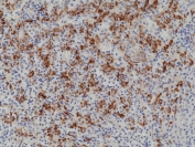 IHC staining of FFPE human spleen tissue with recombinant CD163 antibody at 1:1000.