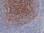 IHC staining of FFPE human tonsil tissue with recombinant CD21 antibody at 1:1000.
