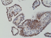 IHC staining of FFPE human thyroid tissue with recombinant c-Fos antibody at 1:1250.