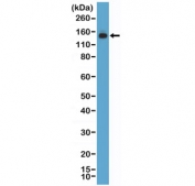 Western blot testing of human HEK293 cell lysate with recombinant MSH6 antibody at 1:1000 dilution. Expected molecular weight: 120-160 kDa depending on phosphorylation level.