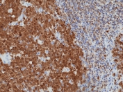 IHC staining of FFPE human tonsil tissue with recombinant BOB-1 antibody at 1:1250.