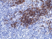 IHC staining of FFPE human thymus tissue with recombinant TdT antibody at 1:200.