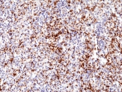 IHC staining of FFPE human spleen tissue with recombinant CD61 antibody at 1:500.