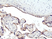 IHC staining of FFPE human placental tissue with recombinant Transferrin Receptor antibody at 1:500.