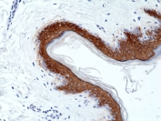 IHC staining of FFPE human skin tissue with recombinant Cytokeratin 10 antibody at 1:1000.