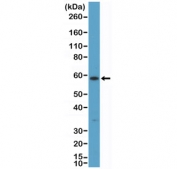 Western blot testing of human A431 cell lysate with recombinant Cytokeratin 10 antibody at 1:200 dilution. Predicted molecular weight ~59 kDa.